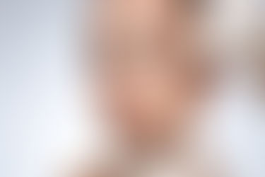 What Transformations Are Common in Makeover Cosmetic Surgery?