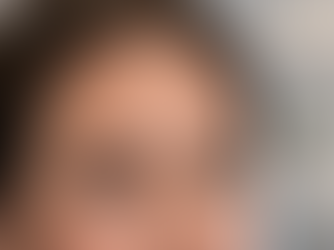 Opening the Eyes: How Brow Positioning Redefines the Upper Third