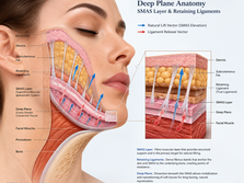 Deep Plane Vectoring: Why Modern Surgical Lifting Outperforms Surface Tension