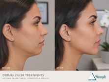 The Art of Symmetry: Finding Balance Without Surgery