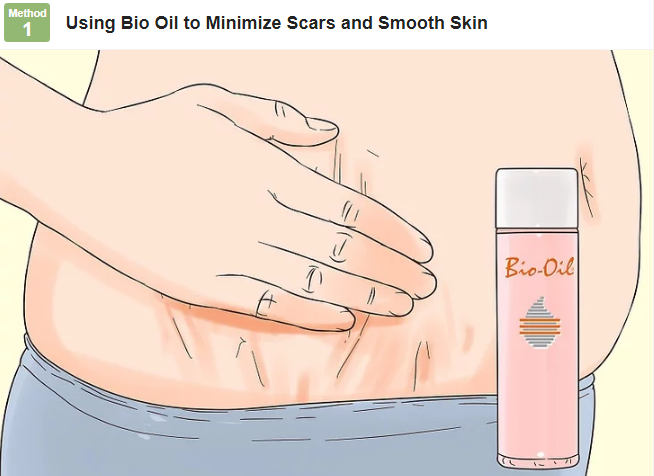 best bio oil for scars