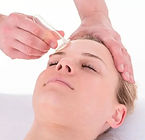 Facial cupping_edited.jpg