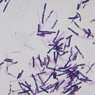 B9781416024064500491_f44-02-978141602406