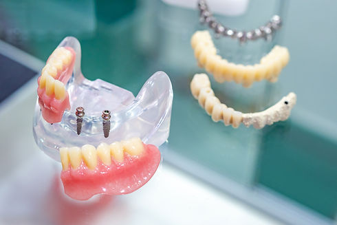 Denture acrylique amovible