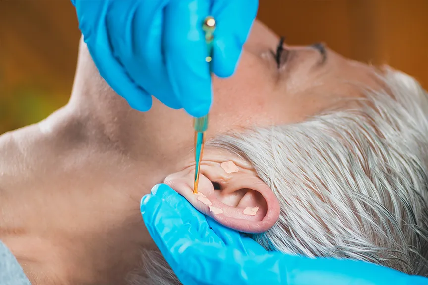 EAR ACU THERAPY