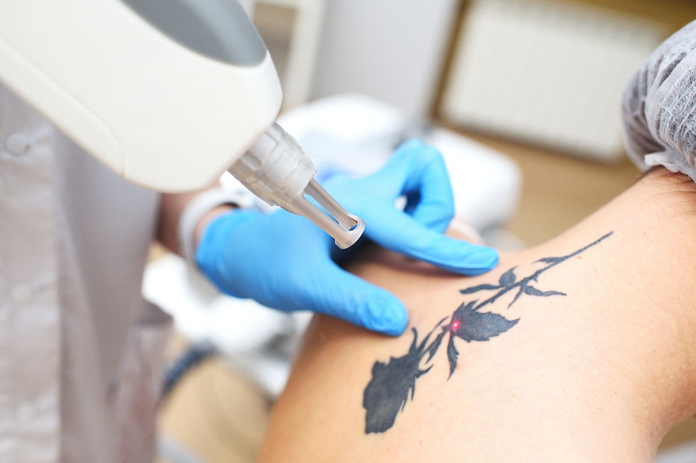 cosmetologist-removes-the-tattoo-to-the-patient-us-2026-01-06-10-12-55-utc_edited.jpg