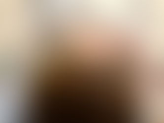 美容鍼で10歳若返る!?