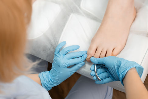 Close up of a pedicure master is cutting and removing ingrown toenail on a female foot in