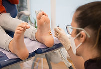 Verruca treatment in Lancaster and Morecambe