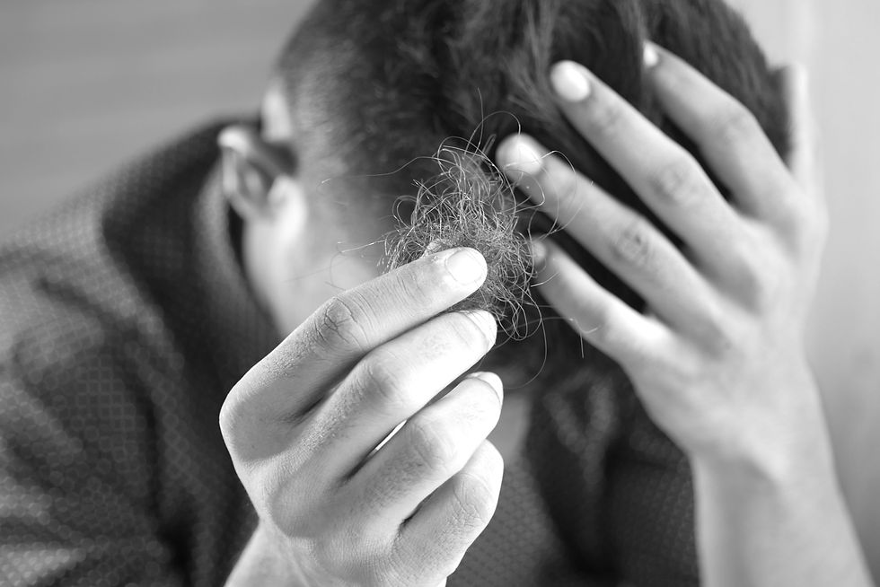 frustrated man with a clump of hair in his fingers