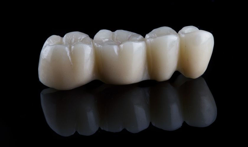 Dental Crowns