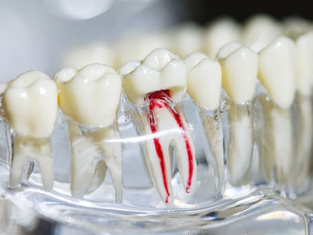 Is a Retreatment of a Root Canal Painful?