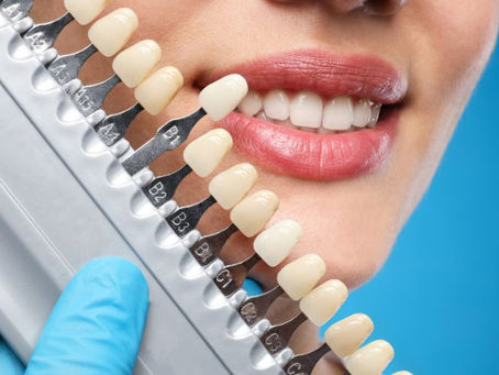 Can Dentists Help with Cosmetic Dentistry?