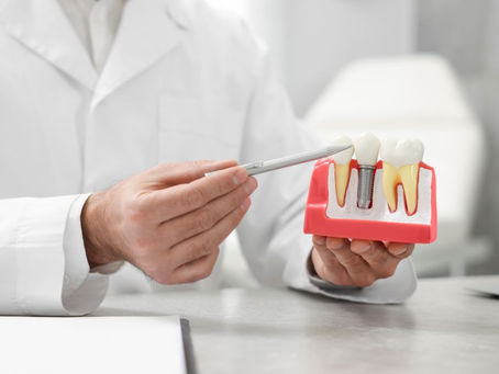 How Painful Is Getting a Dental Implant?