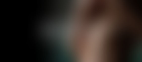 Remodelamento costal: tudo o que você precisa saber sobre essa técnica da cintura dos sonhos