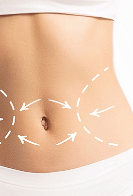 mini abdominoplastia.jpeg