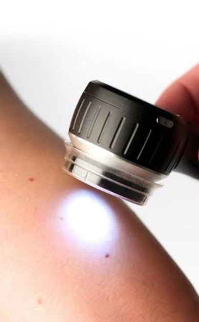 Dermatoscopia.jpg