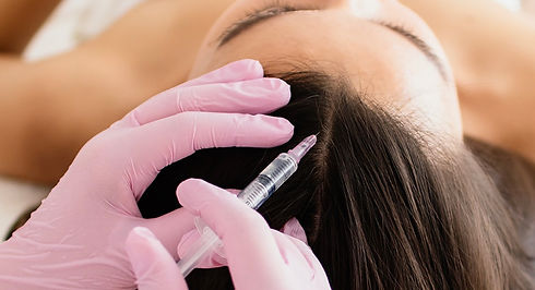Mesoterapia. Capilar.jpg