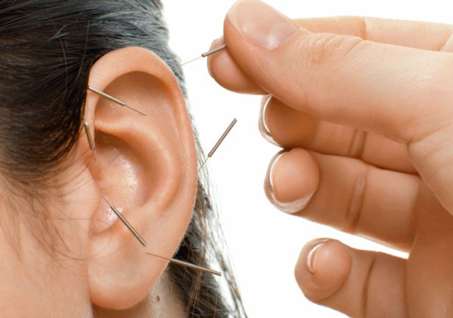 acupuntura-auricular.jpg