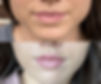 Contact Artox Aesthetics