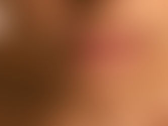 Polynucleotides and Fillers for Lip Improvement