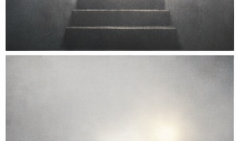 4-TÜRKİYE'DE OTİZM: NEDEN BAZI ÇOCUKLAR DÜZELMEZ?