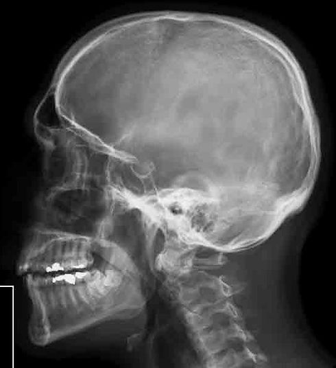 tac-cranio-medical-imaging_edited.jpg