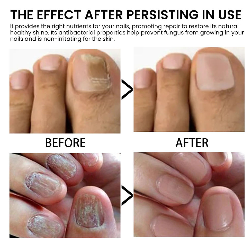 Miniatura: West&Month Nail Strengthening Oil for Healthy Nails