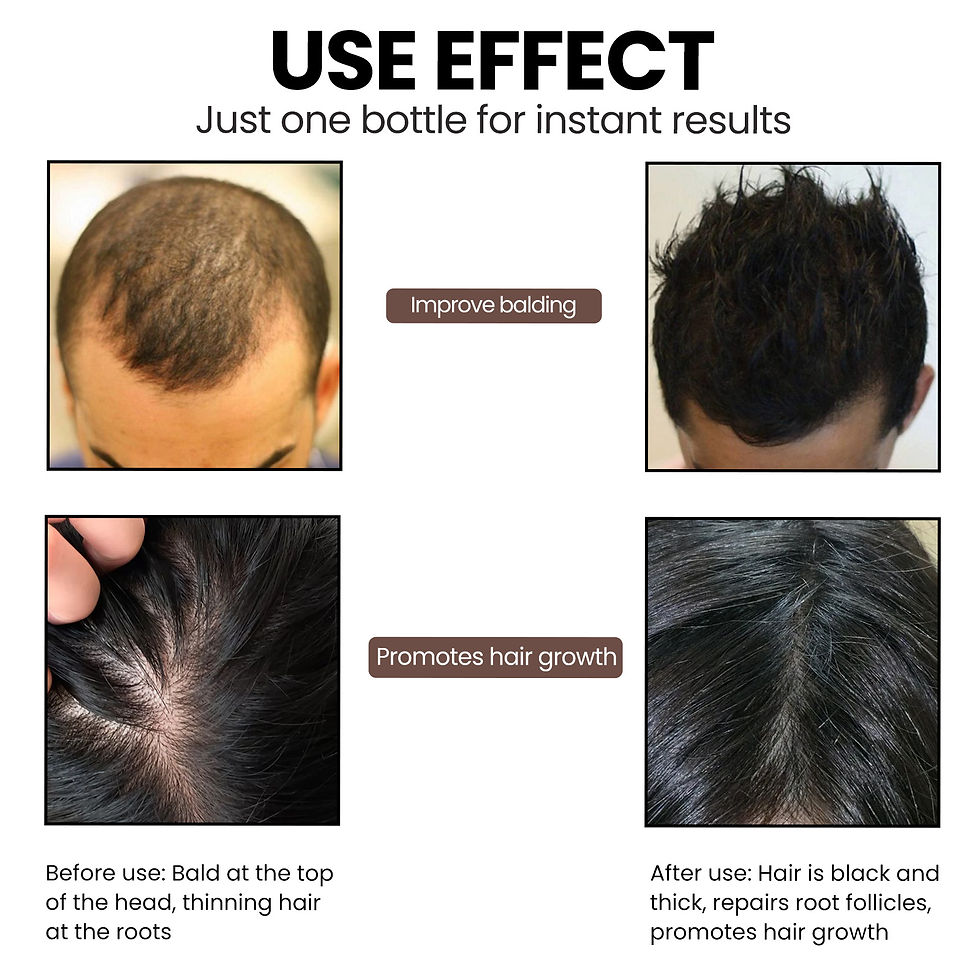 Thumbnail: EELHOE Hair Strengthening Essence for Nourished Roots
