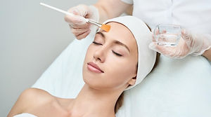 Chemical Peel.jpeg