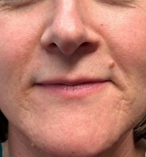 Before & After Photo