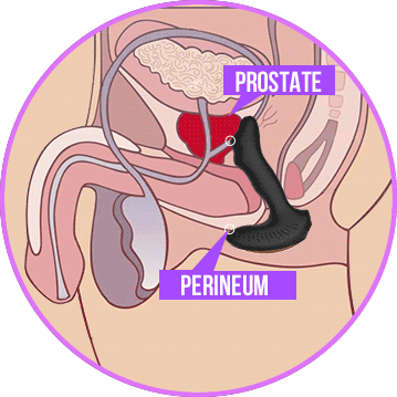 Moodtime prostate sex toys