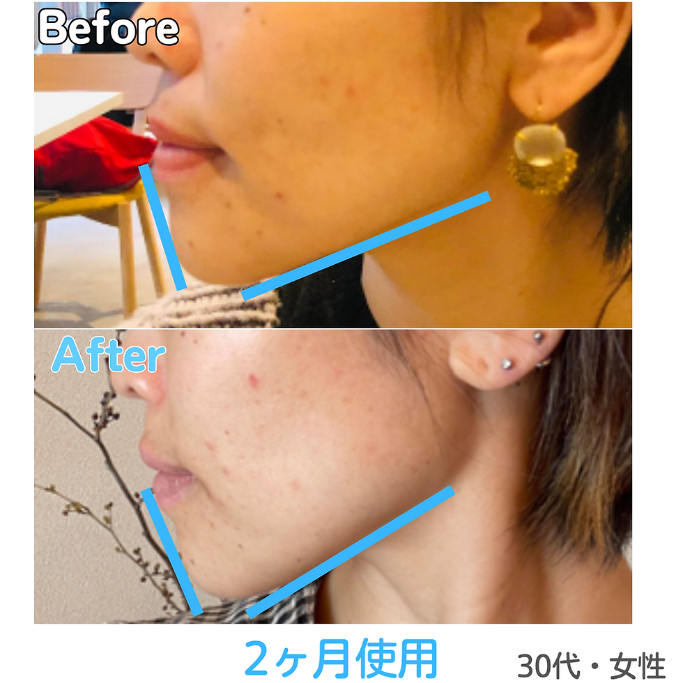 369マウスピース 369マウスピース 369マウスピース