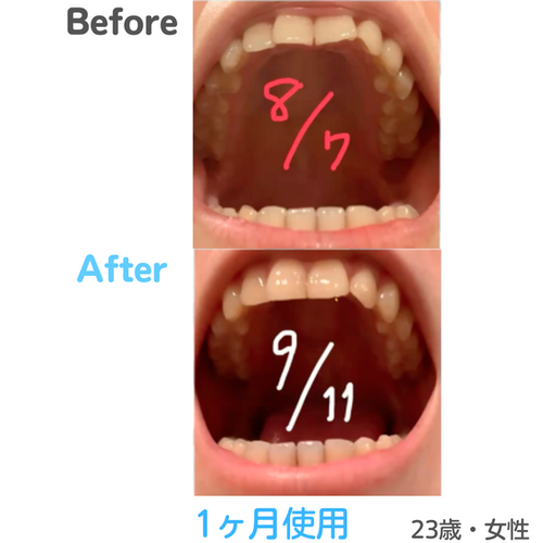 ミロクマウスピース（369mouthpiece） | Prosper Beauty Shop