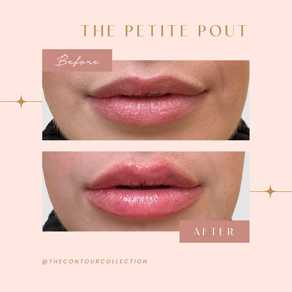 The Petite Pout