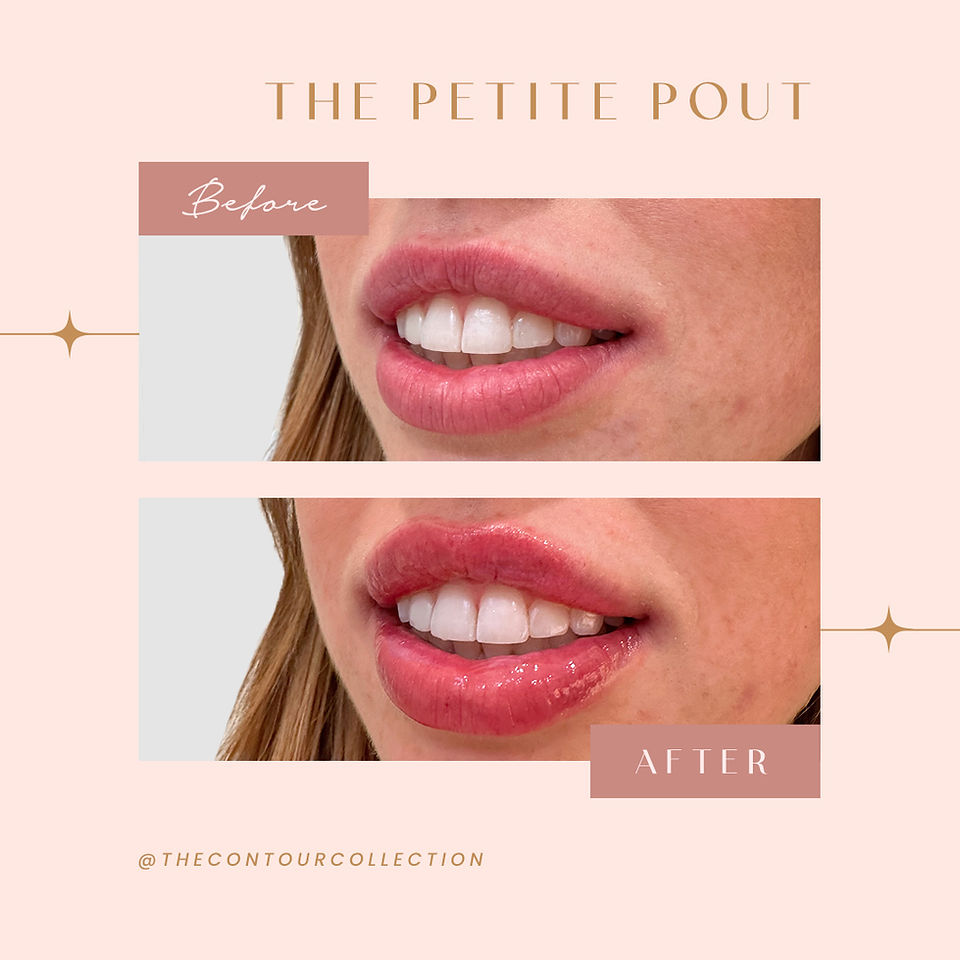The Petite Pout