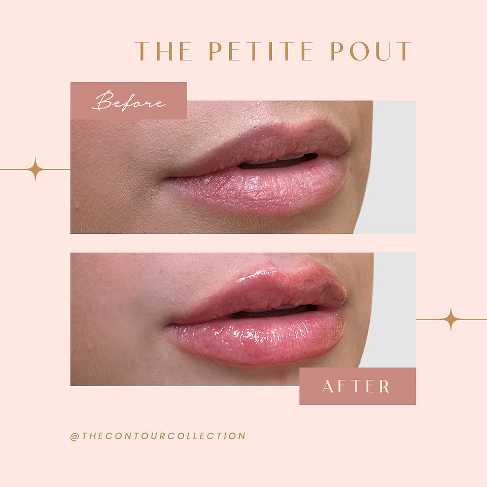 The Petite Pout