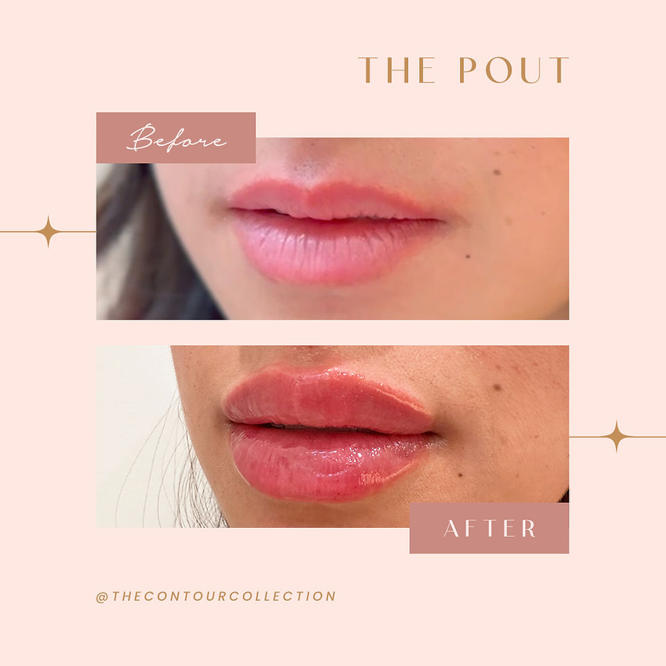 The Pout