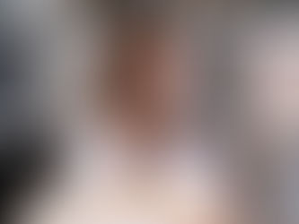 腳腫又痛 - 靜脈曲張｜久坐久站最易得靜脈曲張 | 預防及治療靜脈曲張方法 | Radiance Special ｜健康特集