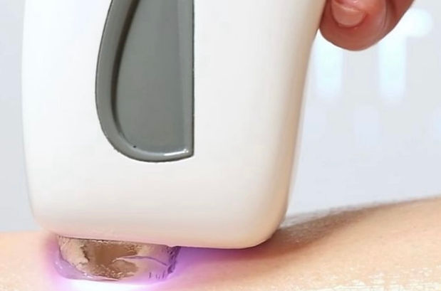 Epilazione laser indolore Nails and Beauty LAB di Silvia Lepore Nichelino (TO)