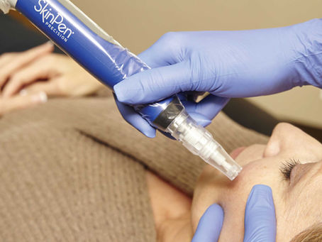 SkinPen Microneedling: Gentle Skin Rejuvenation That Works With Your Skin