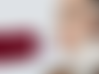 Often described as one of the most subtle and sophisticated treatments available, Sculptra focuses on restoring what time gradually reduces: collagen.