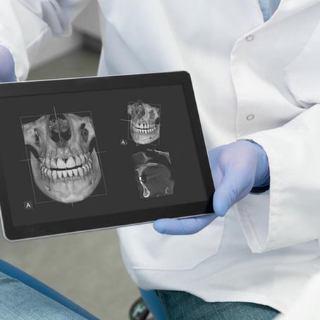 Los beneficios de la Radiografía Digital en Odontólogia