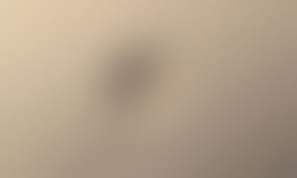 📌 Egg Retrieval Procedure from the Abdomen