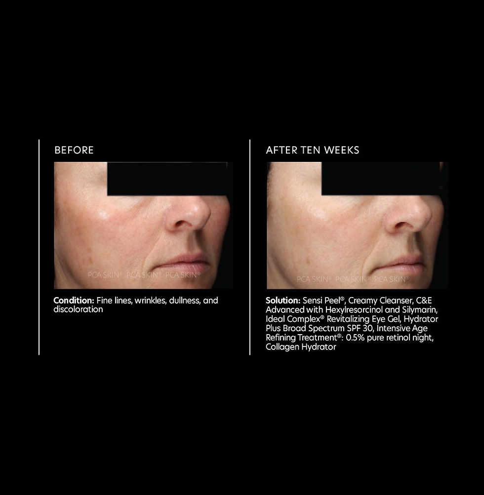 Miniatiūra: C&E Advanced