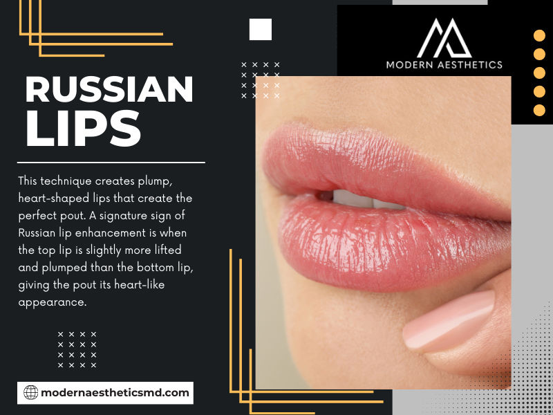 Russian Lips Near Me