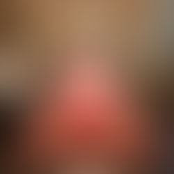 Large-Scale Hospitality and Luxury Projects: Managing Bulk Rug Orders Without Compromising Quality