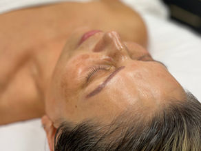 Post-Procell Microchanneling Care