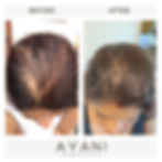 Thumbnail: voor en na resultaten van het gebruiken van de Ayani Organics haar groei olie