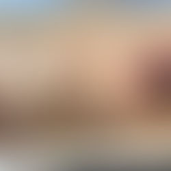 Pork Tenderloin slices with Dijon cream sauce on a white platter.